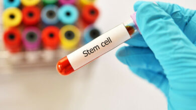 the-benefits-of-stem-cell-therapy-in-dubai:-anti-aging-and-regenerative-medicine-at-aeon-clinic